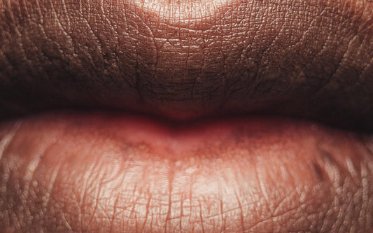 Puistje op lip! Hoe kom je er het beste vanaf? - Activeskin